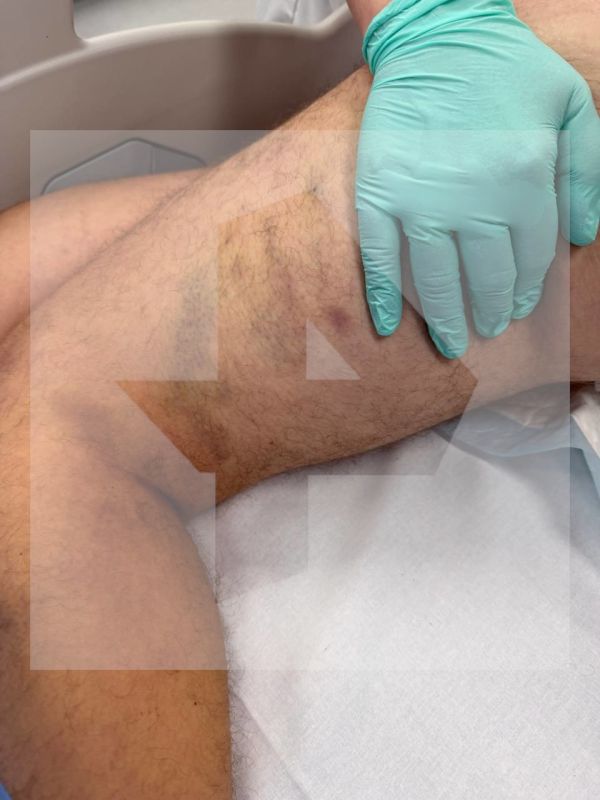 Ужасные гематомы, следы ударов и разрывы тканей обнаружены на теле 16-летнего воспитанника реабилитационного центра в Подмосковье Ужасные гематомы, следы ударов и разрывы тканей обнаружены на теле 16-летнего воспитанника реабилитационного центра в Подмосковье