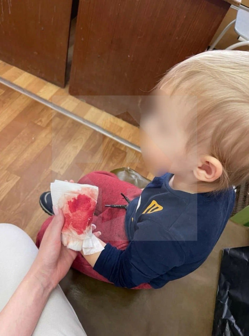 Сломанные пальцы, выбитые зубы и синяки: детей истязают в одном из детсадов Нижегородской области Сломанные пальцы, выбитые зубы и синяки: детей истязают в одном из детсадов Нижегородской области