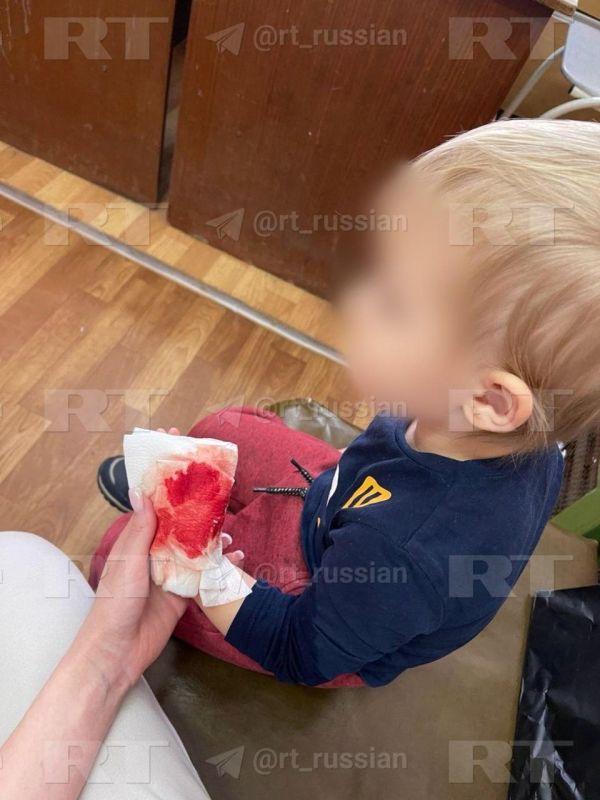 Раздробленные пальцы, синяки и ожоги — травмы, с которыми дети возвращаются из одного из детских садов Нижнего Новгорода