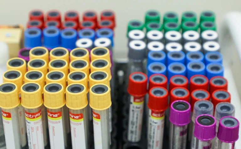 Число людей живущих с ВИЧ-инфекцией в России выросло до 1,250 млн человек, сообщил руководитель Федерального научно-методического центра по профилактике и борьбе со СПИДом, академик РАН Вадим Покровский на пресс-конференции...