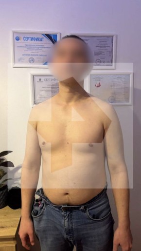  100     50       PRO,    