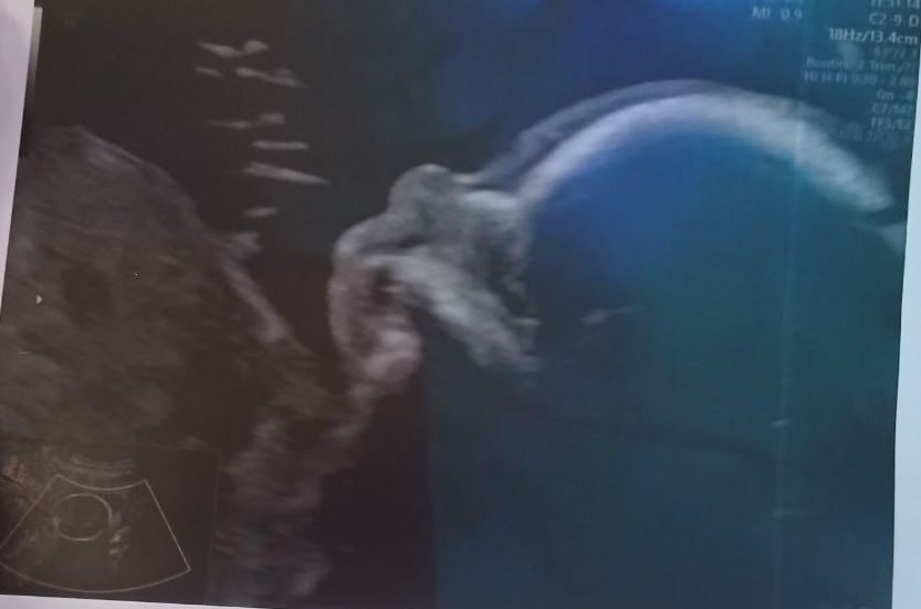 Утопила новорожденного сына: блогер и автор курса по родовой системе убила собственного ребенка в тазу с водой, сообщили в Следкоме Петербурга Утопила новорожденного сына: блогер и автор курса по родовой системе убила собственного ребенка в тазу с водой, сообщили в Следкоме Петербурга