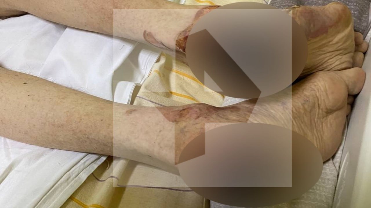 Мужчина "сварился" в кипятке, принимая ванну в Обнинске Мужчина "сварился" в кипятке, принимая ванну в Обнинске