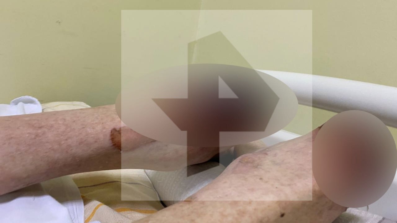 Мужчина "сварился" в кипятке, принимая ванну в Обнинске Мужчина "сварился" в кипятке, принимая ванну в Обнинске