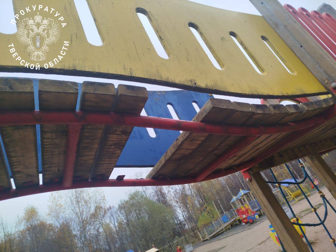 Прокуратура взыскала с муниципалитета компенсацию морального вреда за полученную ребенком травму