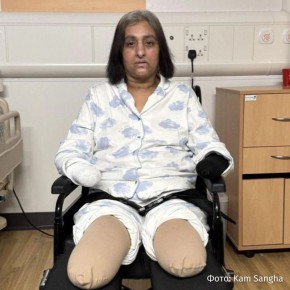 Британке ампутировали все конечности после того, как ее облизала собака